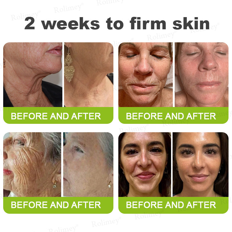 🖤Rolimey® Botox & Vita-A Retinol Shot Wrinkle-Lift Tightening cream - Last Day Promotion 70% OFF