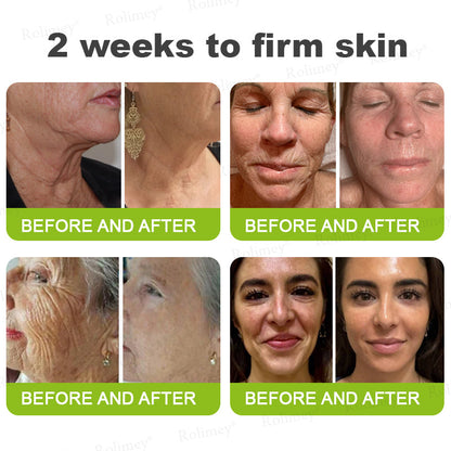 🖤Rolimey® Botox & Vita-A Retinol Shot Wrinkle-Lift Tightening cream - Last Day Promotion 70% OFF