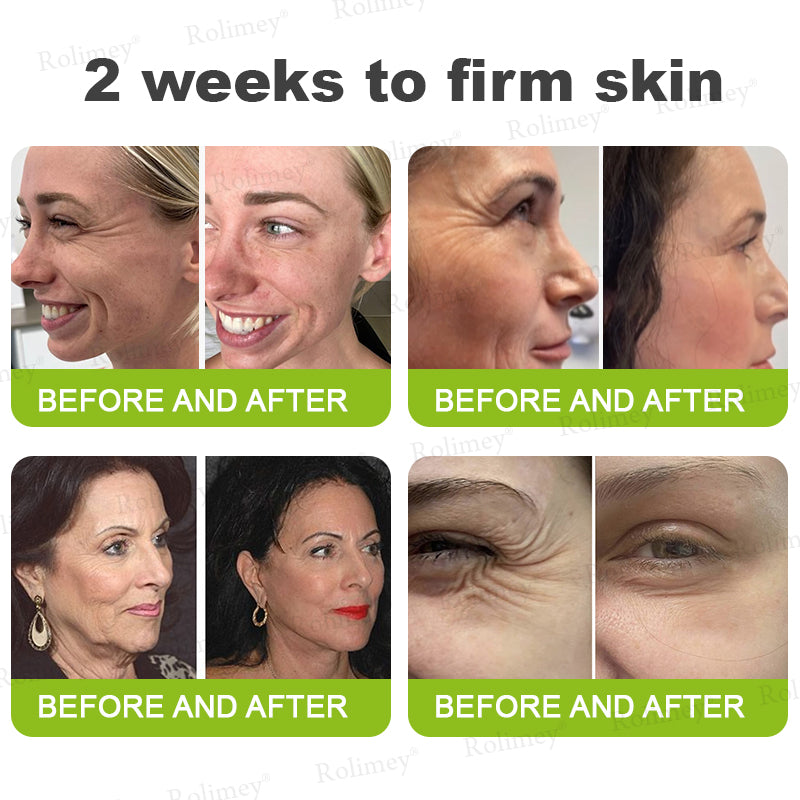 🖤Rolimey® Botox & Vita-A Retinol Shot Wrinkle-Lift Tightening cream - Last Day Promotion 70% OFF