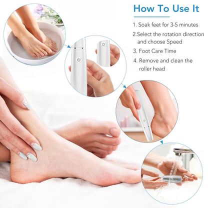 🎁Portable Electric Feet Callus Remover
