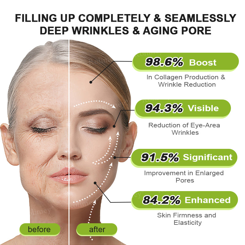 🖤Rolimey® Botox & Vita-A Retinol Shot Wrinkle-Lift Tightening cream - Last Day Promotion 70% OFF