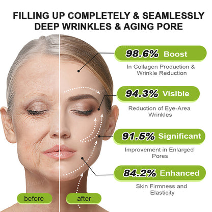 🖤Rolimey® Botox & Vita-A Retinol Shot Wrinkle-Lift Tightening cream - Last Day Promotion 70% OFF