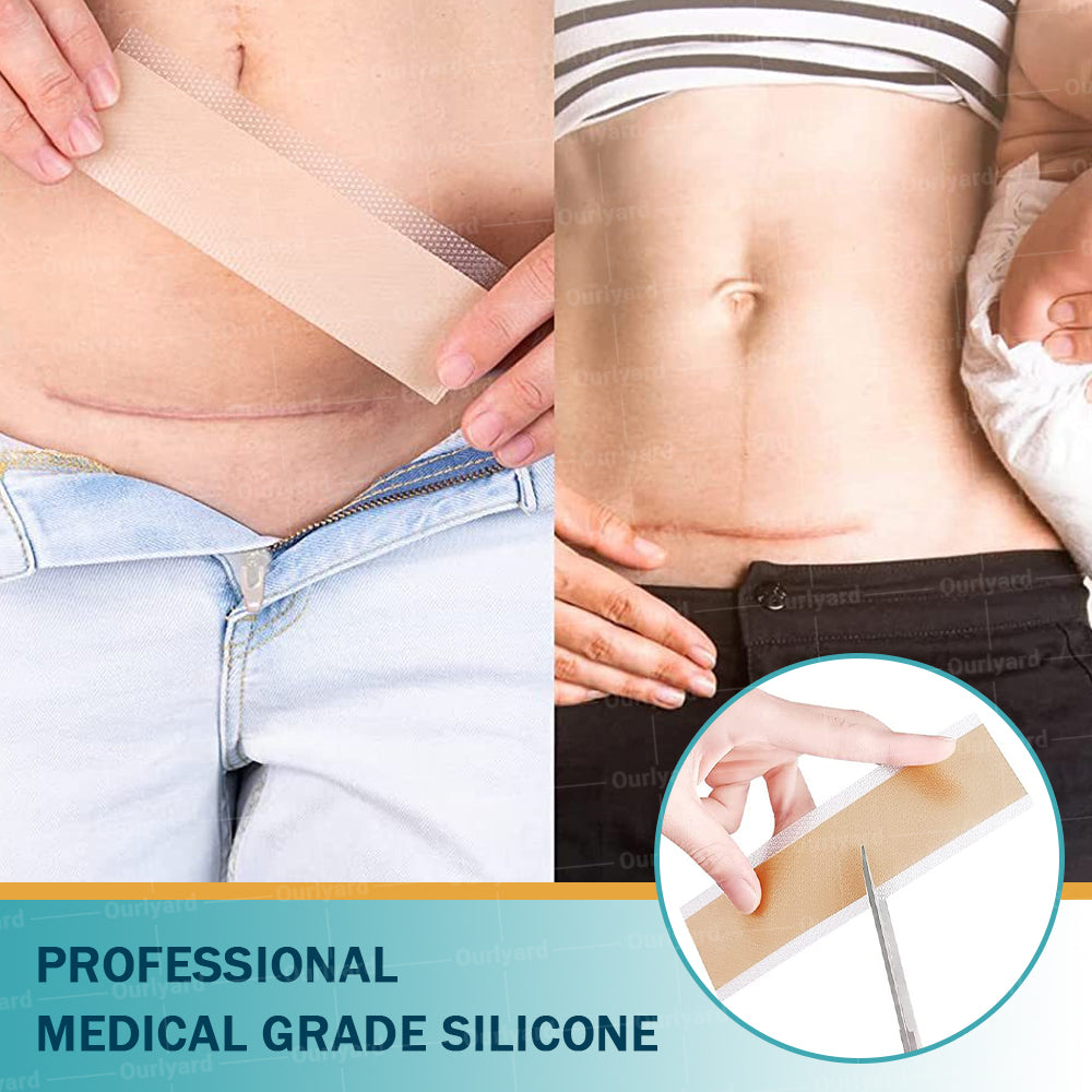 ❤︎Official Store |Ourlyard® Hyaluronic Acid Nano Microneedle Repair Tape🗽🎉(Treatment of old and new scars, reduction of surgical scars, stretch marks, keloids, acne, burns, warts, dermatomes and varicose veins) (upsell)