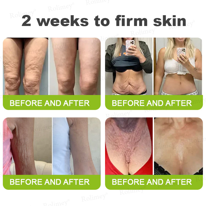 🖤Rolimey® Botox & Vita-A Retinol Shot Wrinkle-Lift Tightening cream - Last Day Promotion 70% OFF