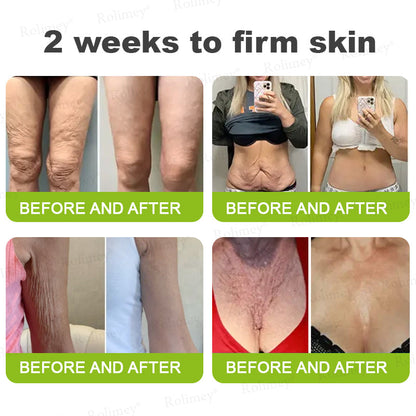 🖤Rolimey® Botox & Vita-A Retinol Shot Wrinkle-Lift Tightening cream - Last Day Promotion 70% OFF