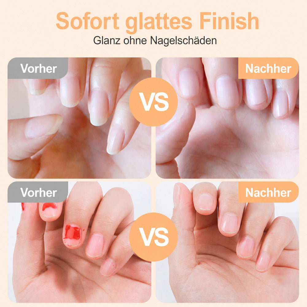 🌟 2-in-1-Smart-Elektronagelschere & -Polierer ✂️💅