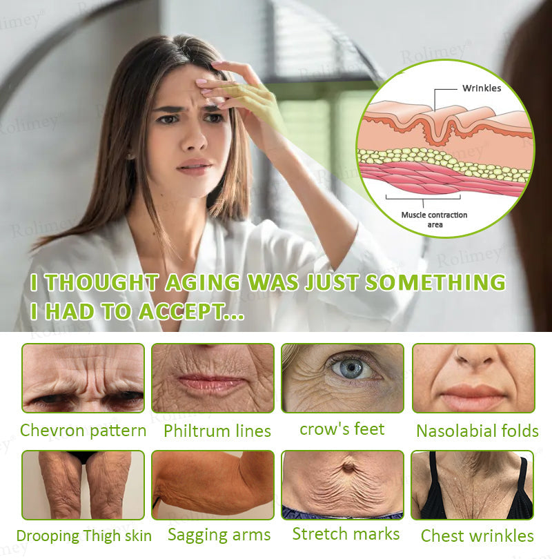 🖤Rolimey® Botox & Vita-A Retinol Shot Wrinkle-Lift Tightening cream - Last Day Promotion 70% OFF
