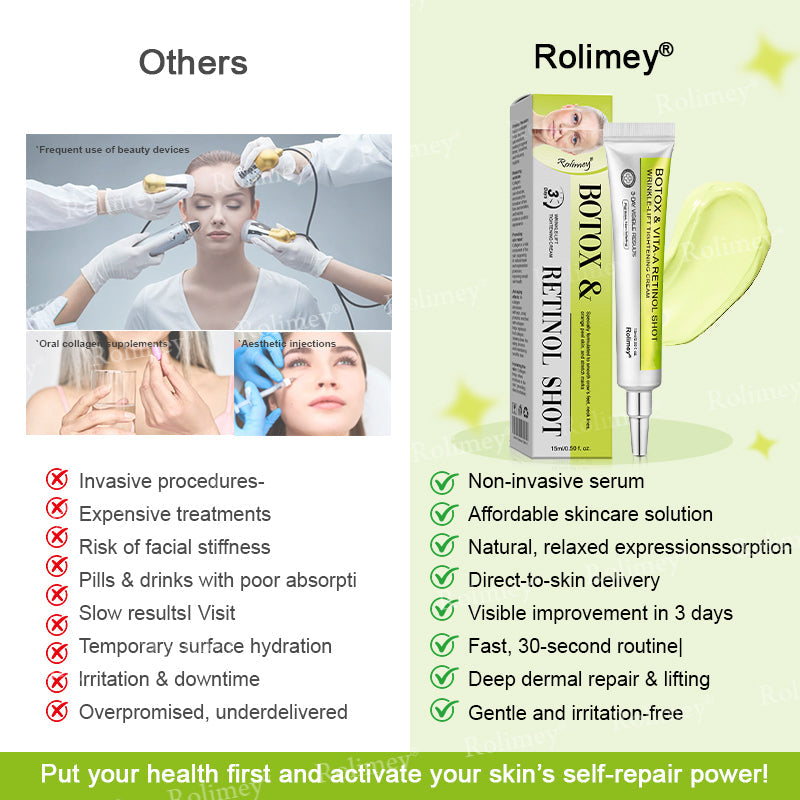 🖤Rolimey® Botox & Vita-A Retinol Shot Wrinkle-Lift Tightening cream - Last Day Promotion 70% OFF