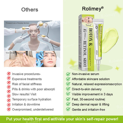 🖤Rolimey® Botox & Vita-A Retinol Shot Wrinkle-Lift Tightening cream - Last Day Promotion 70% OFF