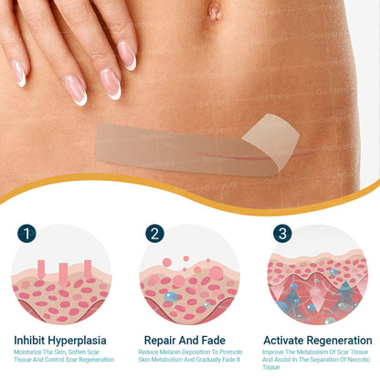 ❤︎Official Store |Ourlyard® Hyaluronic Acid Nano Microneedle Repair Tape🗽🎉(Treatment of old and new scars, reduction of surgical scars, stretch marks, keloids, acne, burns, warts, dermatomes and varicose veins) (upsell)