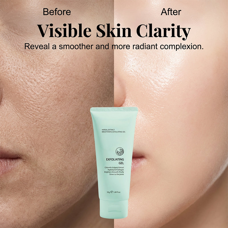 🥳2026 HOT SALE🥳💞50K+ SOLD!💥👵🌸 48% OFF!Herbal Extract Brightening Exfoliating Gel